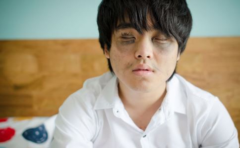 肝肾阴虚有什么症状 肝肾阴虚的症状是什么 肝肾阴虚怎么办