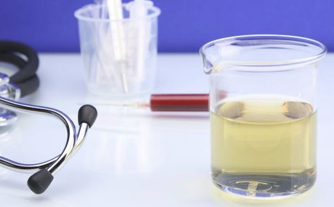 女性尿酸低是什么原因 尿酸正常范围是多少 尿酸低有哪些危害