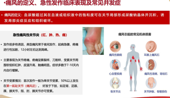 从止痛到治本:详解