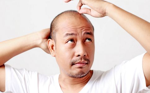 严重脱发需要植发吗 哪些人不适合植发 植发有人群要求吗